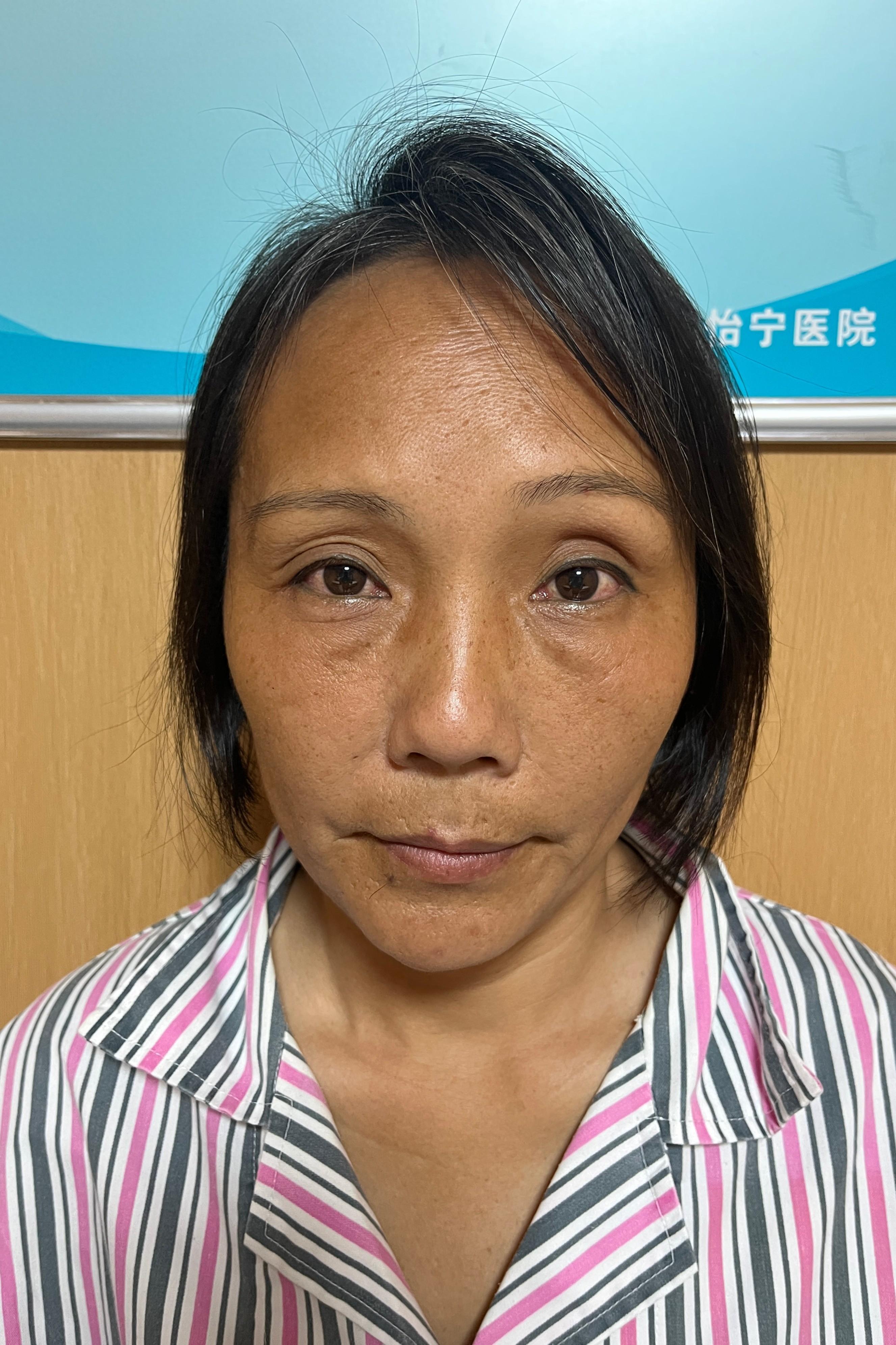 海口市救助李英找家2409242125.jpg