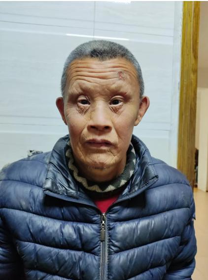 桐柏县救助无名找家2204201559.jpeg